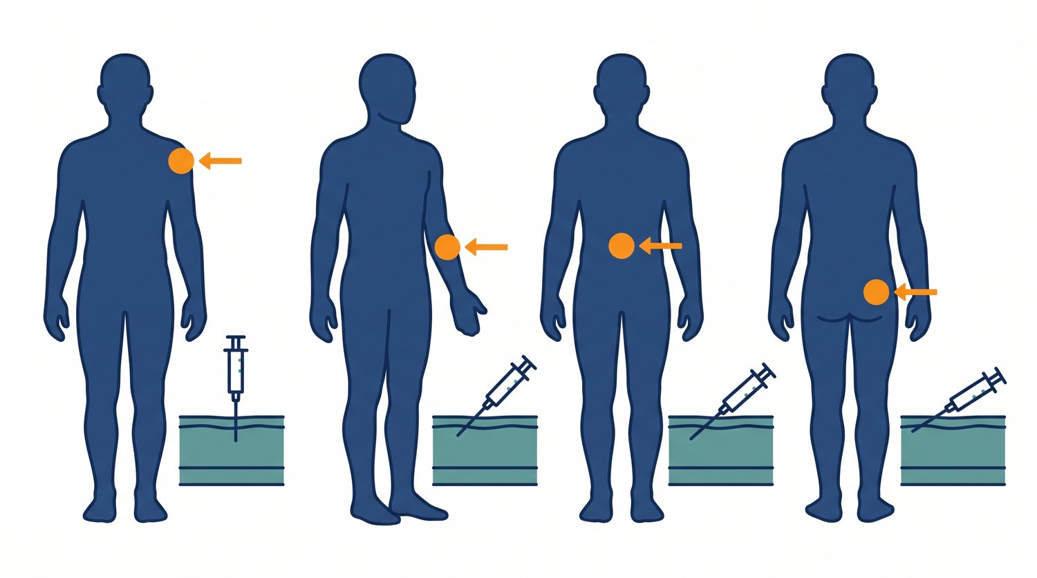 Las cuatro vías de inyección: intramuscular, intravenosa, subcutánea e intradérmica, con el ángulo de la aguja en cada una